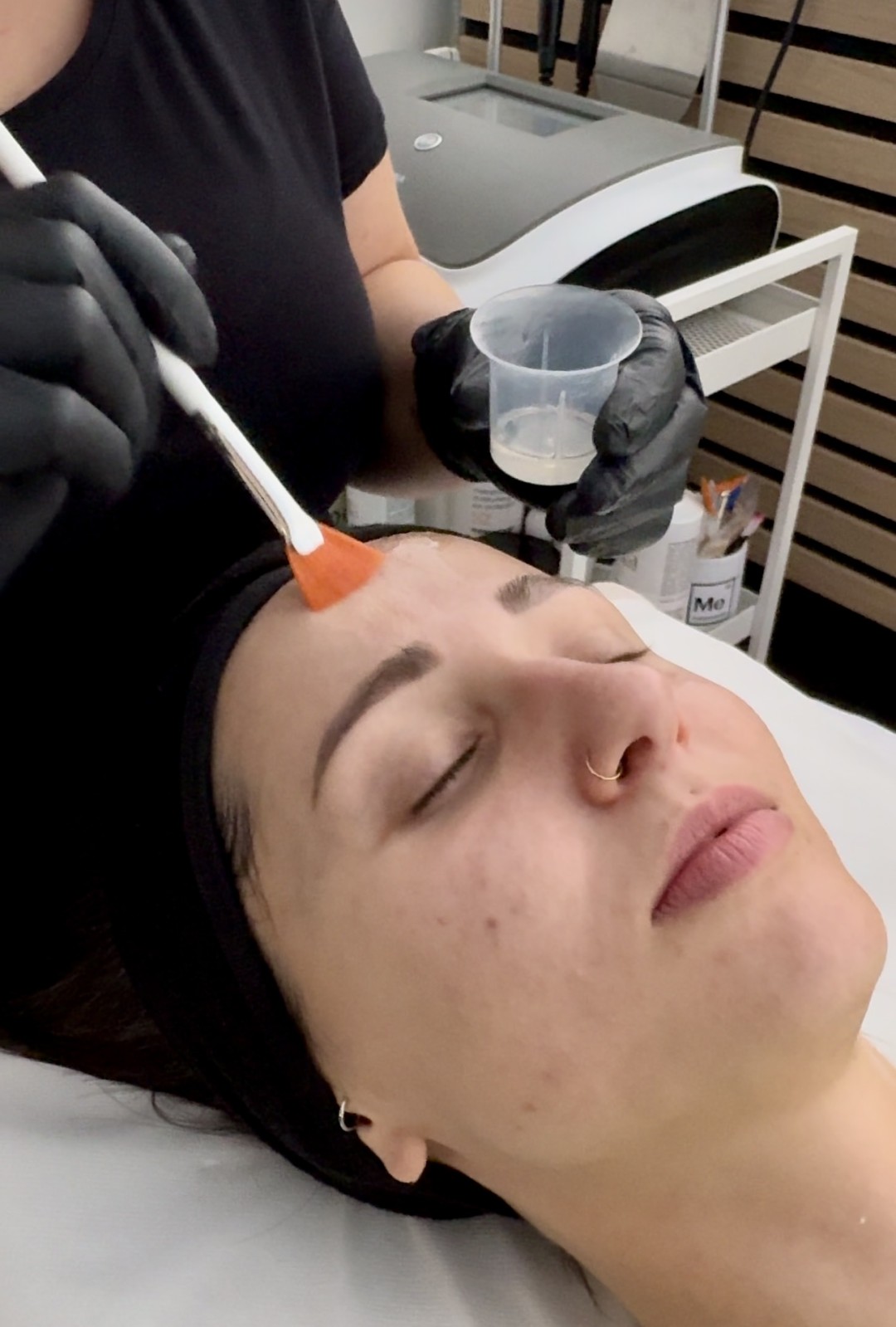 Vanja’s Beautique #zagreb Tretman lica Kemijski piling lica