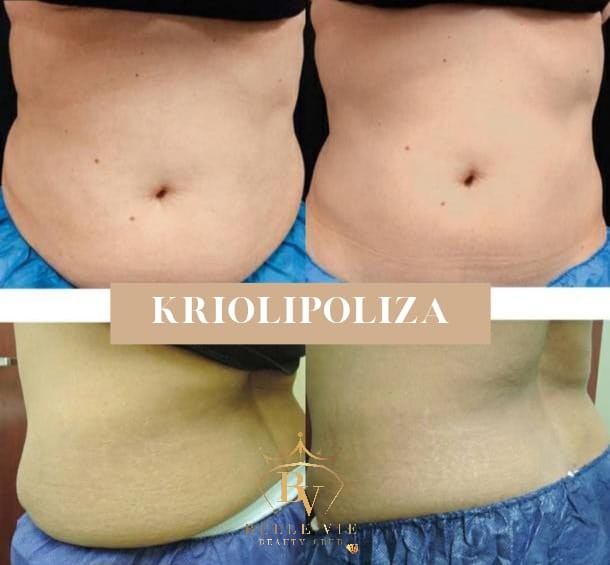 Belle Vie Beauty Club #zagreb