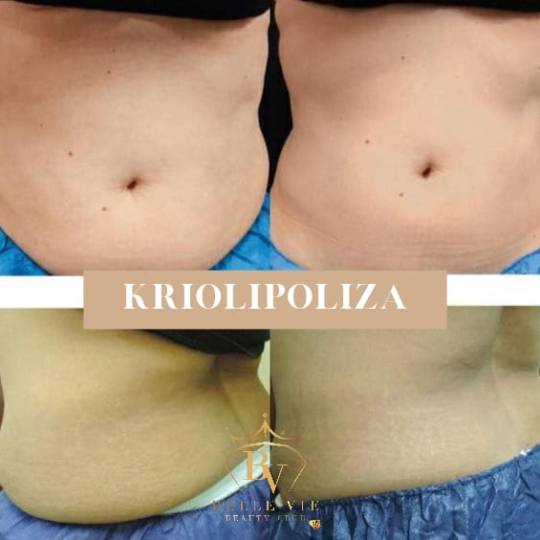 Belle Vie Beauty Club #zagreb