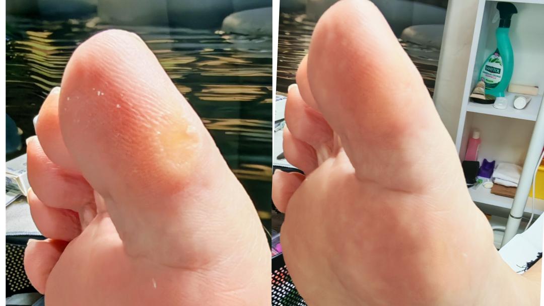 Estetska pedikura s trajnim lakom - Skin Care Beauty, Rijeka Estetska pedikura Nokti Estetska pedikura, Rijeka, Zamet