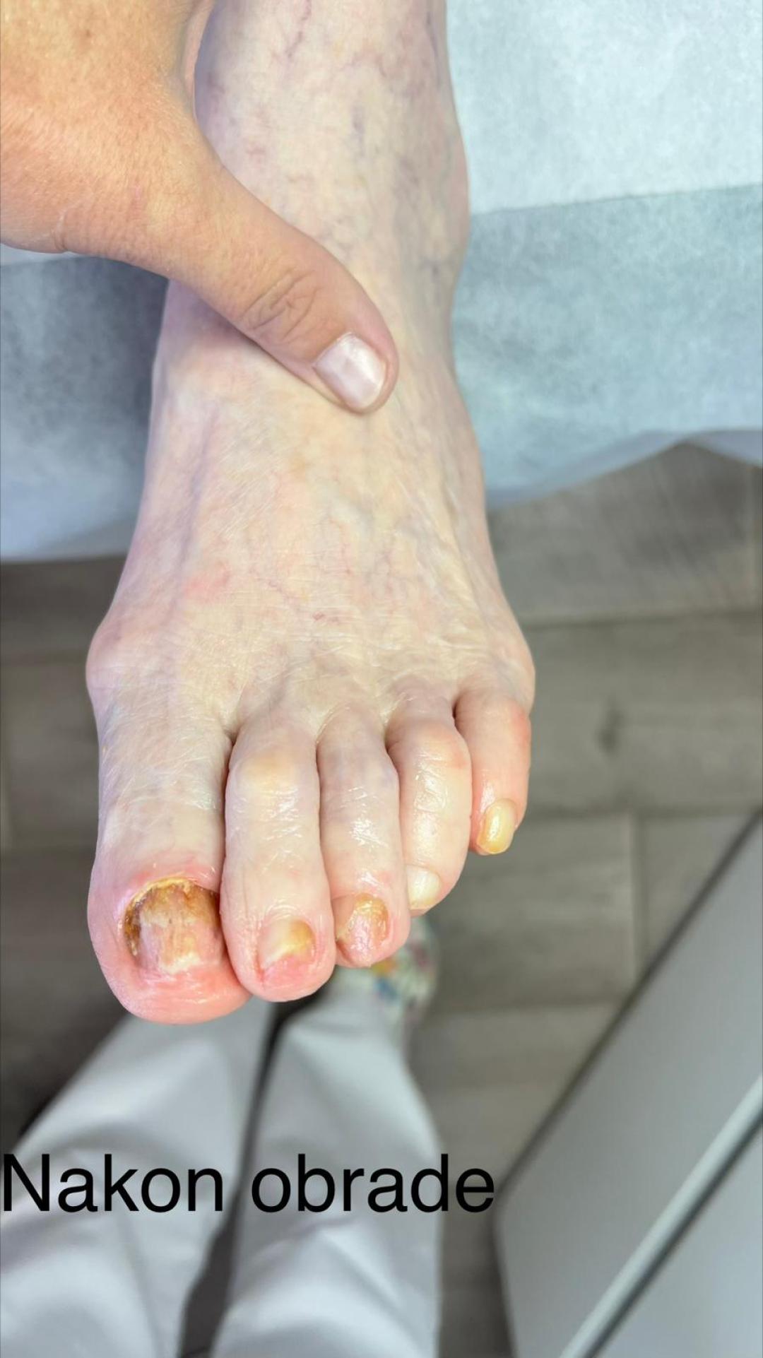 Pedi Feet studio Laura #zagreb