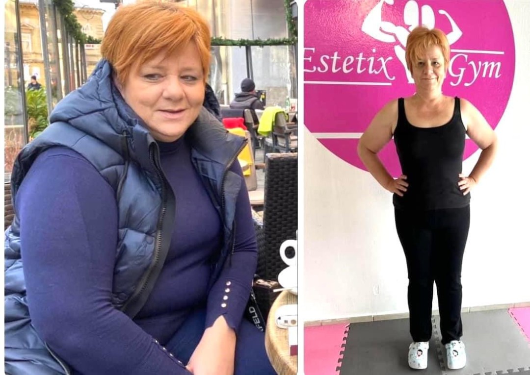 Estetix centar #zagreb Tretmani tijela Hard core paket tretmana