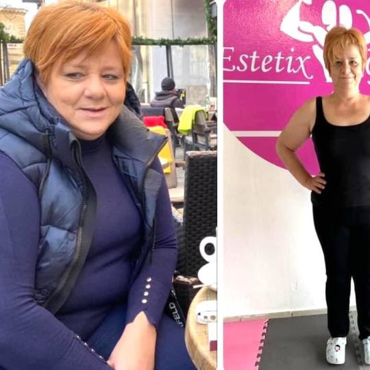 Estetix centar #zagreb Tretmani tijela Hard core paket tretmana Kombinacija tretmana za oblikovanje 