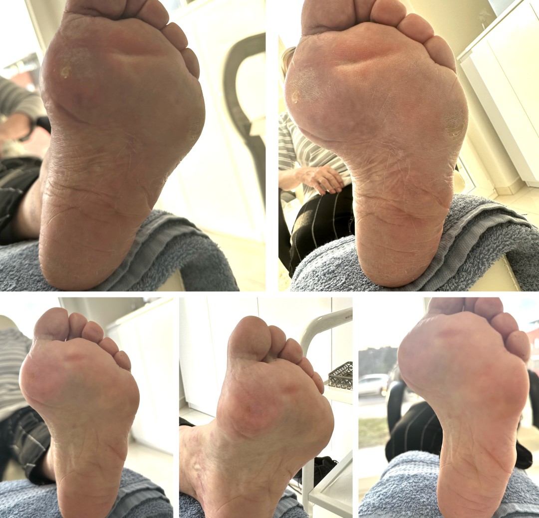 Beauty Centar Sky #zagreb Estetska pedikura Ruska pedikura