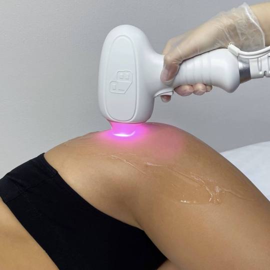 Angela #zagreb Laserska epilacija Laserska epilacija bedara - za dame