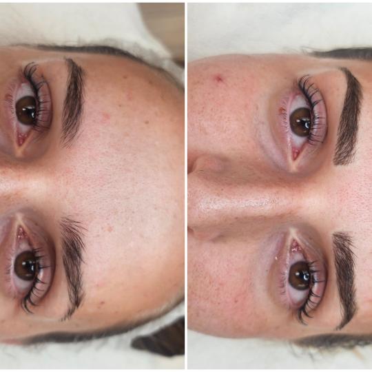Cosmoderm & Centar Estetica usluga