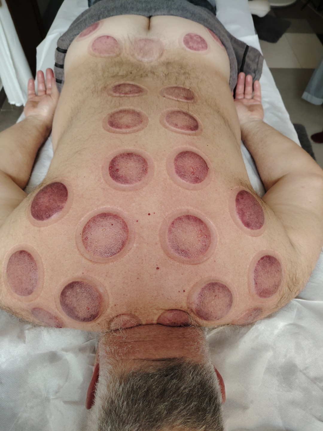 Kombinacija masaže leđa, cupping terapije i masaže stopala AKCIJA!!! - Nirvana Life Therapy, Zagreb Masaža leđa Masaža Masaža leđa, Zagreb, Gornja Dubrava