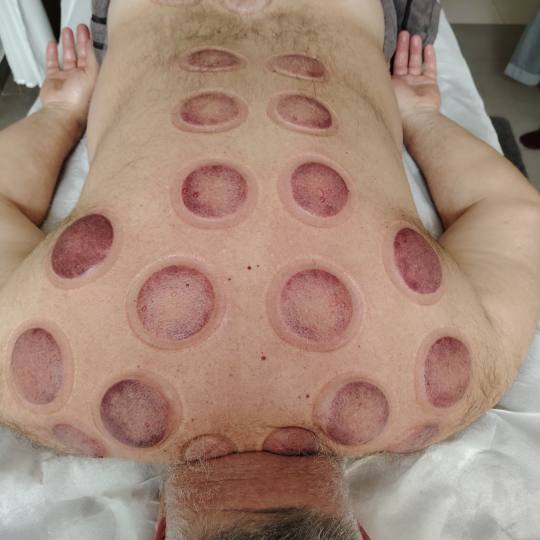 Nirvana Life Therapy usluga