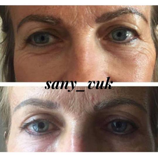 Sany Nails & Cosmetics #zagreb Tretman lica  ACCOR Cosmetics Corrector je nježna alternativa operac