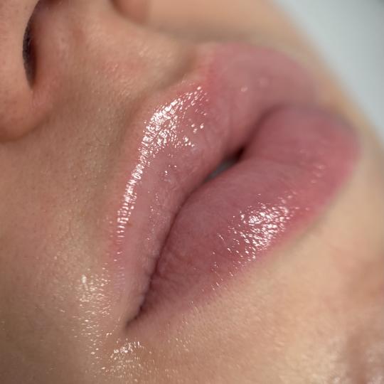 Théa Beauty Spot usluga