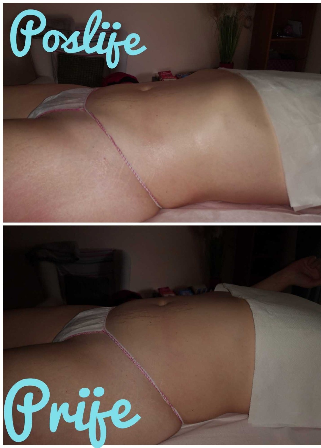 More love beauty #zagreb Masaža za mršavljenje Limfomodelirajuća masaža