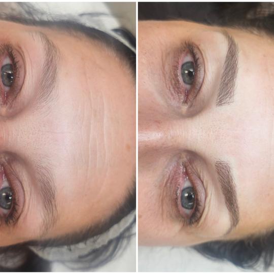 Cosmoderm & Centar Estetica usluga