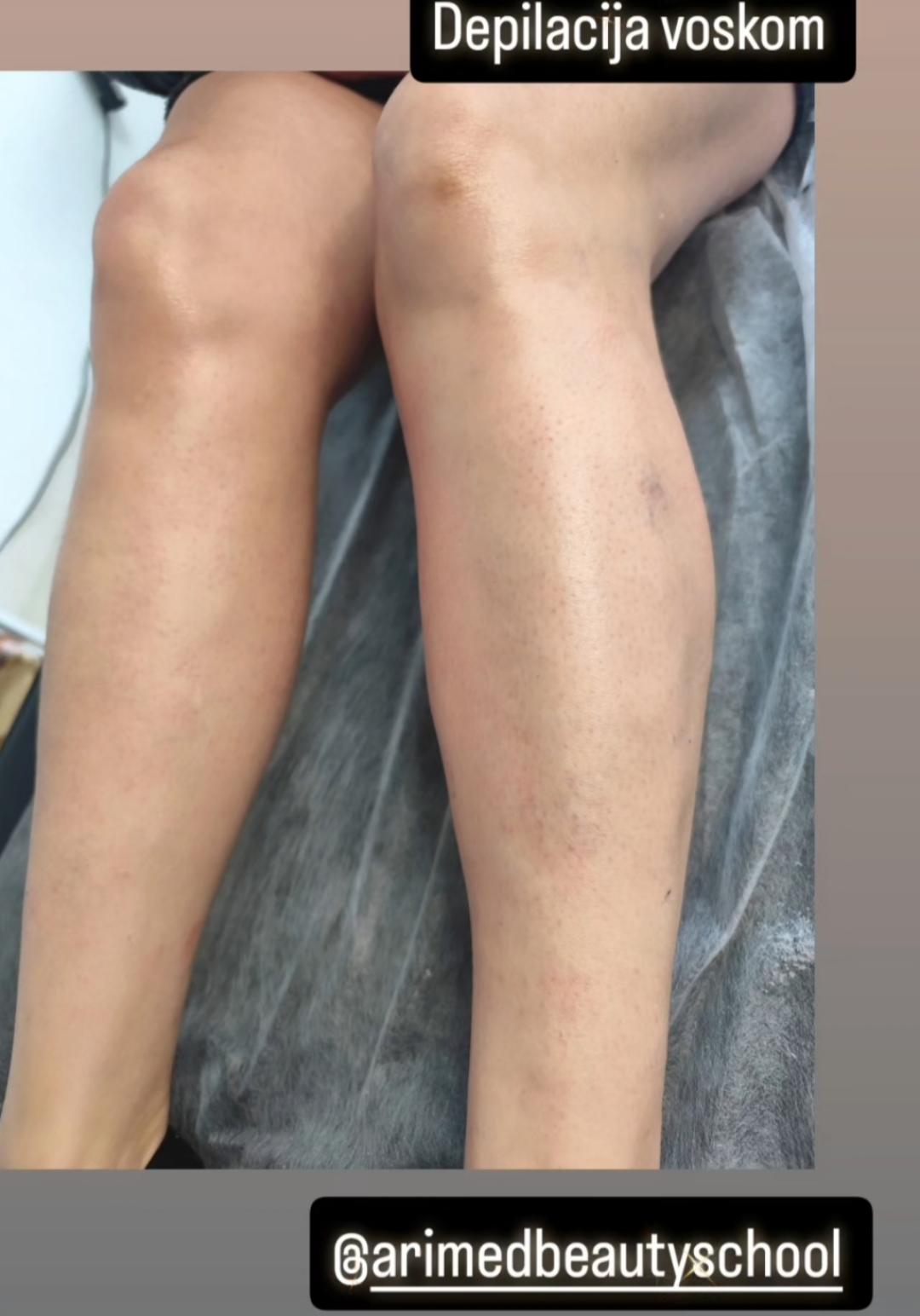 Josea beauty studio #zagreb Depilacija nogu Depilacija cijelih nogu hladnim voskom - za dame