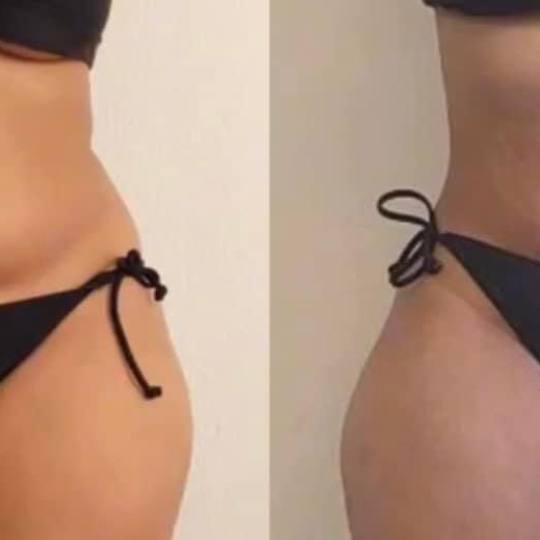 Estetix centar usluga