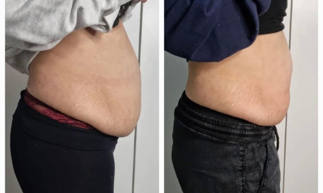 Estetix centar #zagreb