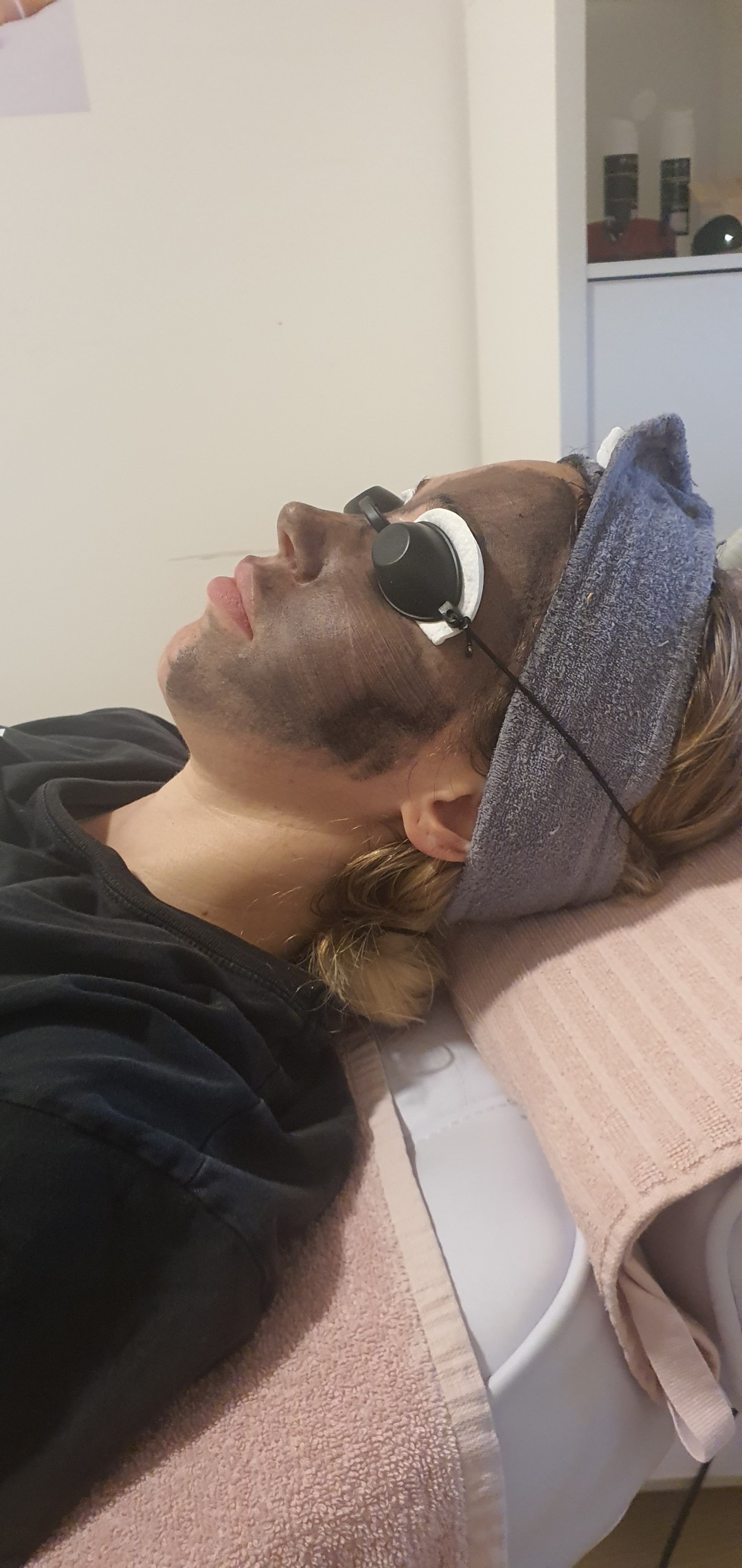 SOLO Beauty Centar #zagreb Laserski tretmani lica Black Doll -carbon peel