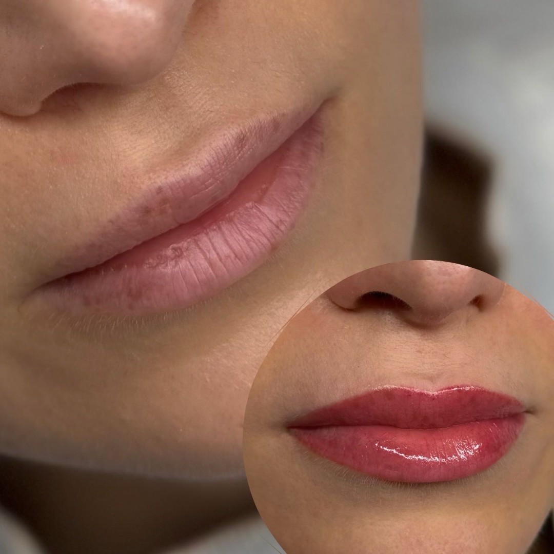 Mikropigmentacija usana /Lip blush - MOELL beauty, Zagreb Trajna šminka Lice Trajna šminka, Zagreb, Peščenica – Žitnjak