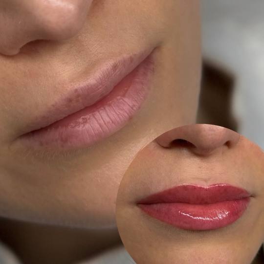 MOELL beauty #zagreb Trajna šminka Mikropigmentacija usana /Lip blush