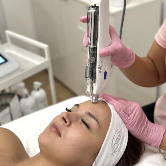Beauty Box - Zagreb #zagreb Tretman lica Mezoterapija lica - Meso chip skin reset