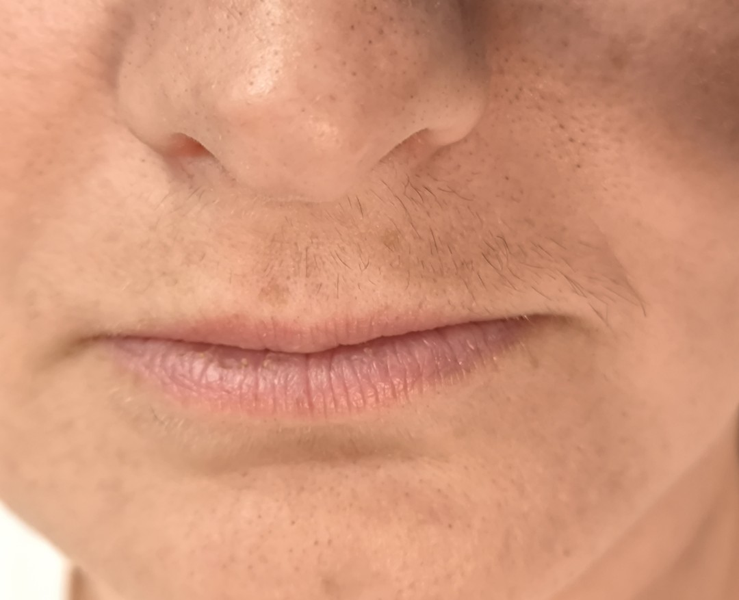 Threading nadusnica - za dame - Mare, Zagreb Tretman lica Lice Tretman lica, Zagreb, Trešnjevka – sjever