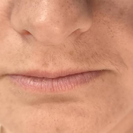 Mare #zagreb Tretman lica Threading nadusnica - za dame Dlačice na lijevoj strani nadusnice smo po�