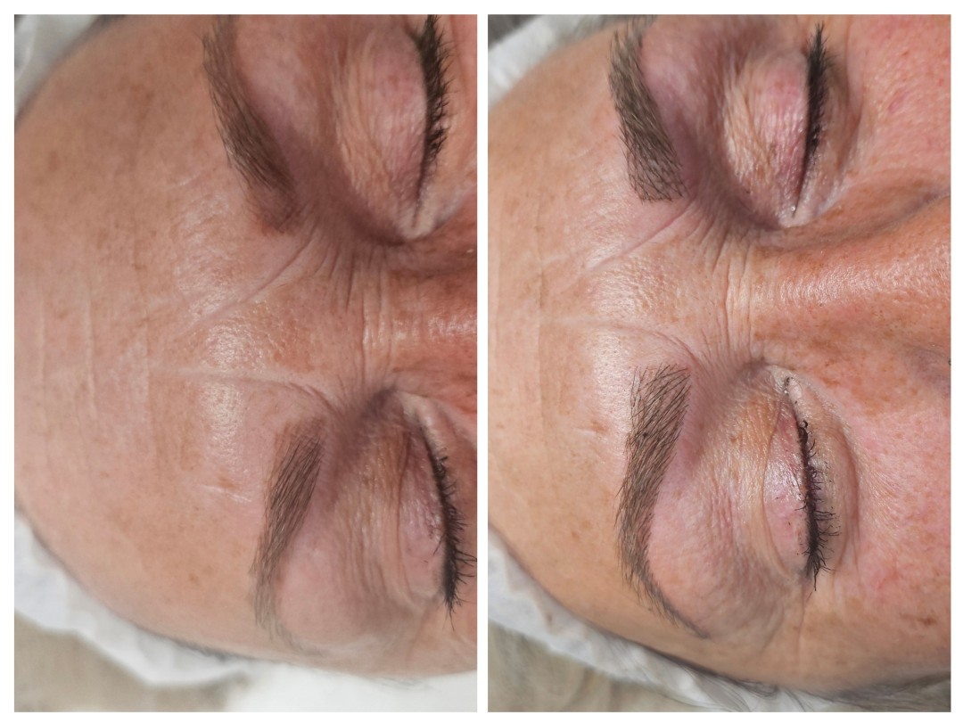 Trajna šminka - iscrtavanje dlačica (hiper realistične obrve) - Cosmoderm & Centar Estetica, Zagreb Trajna šminka Lice Trajna šminka, Zagreb, Trnje