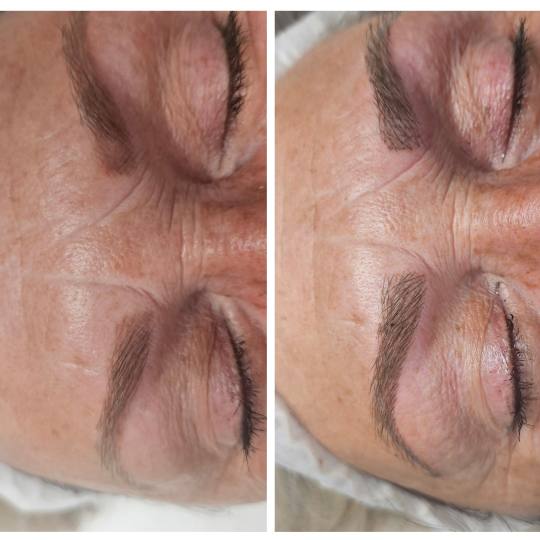 Cosmoderm & Centar Estetica #zagreb Trajna šminka Trajna šminka - iscrtavanje dlačica (hiper real