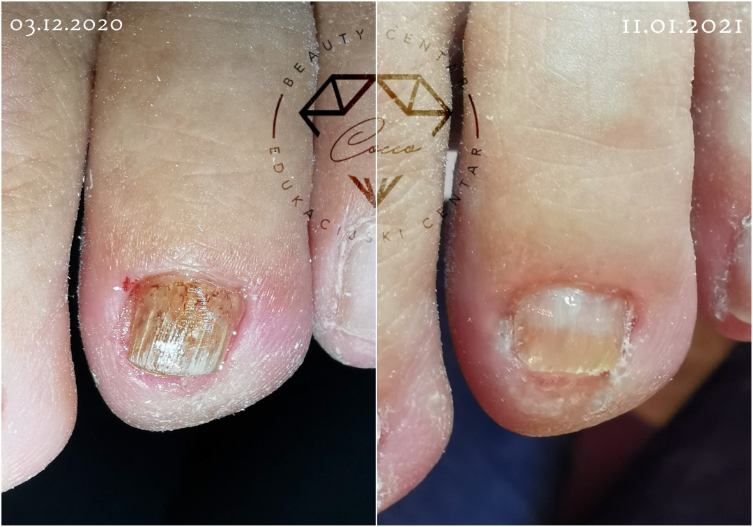 Beauty Centar By Cocco #viskovo Estetska pedikura