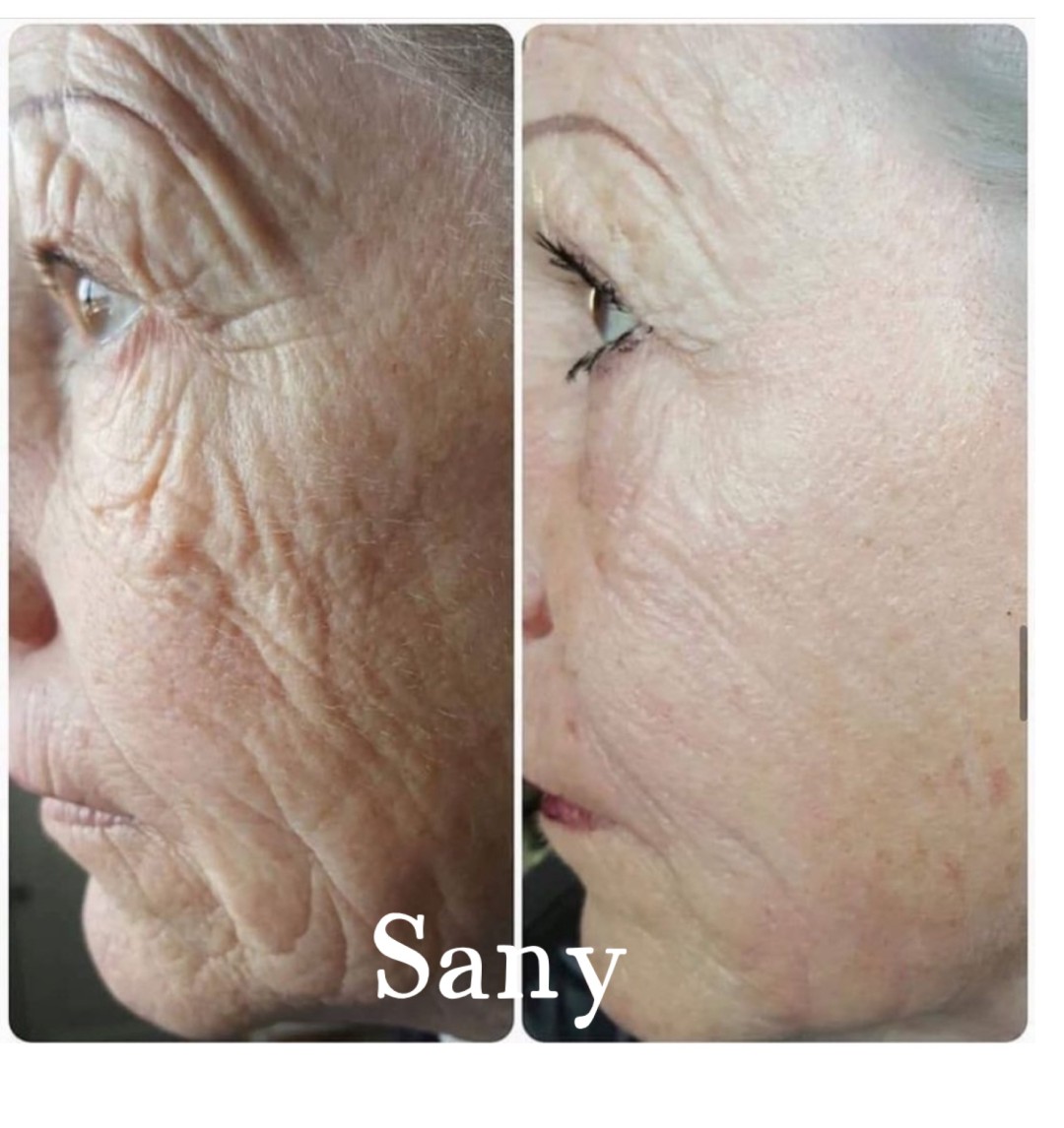 Sany Nails & Cosmetics #zagreb Tretman lica