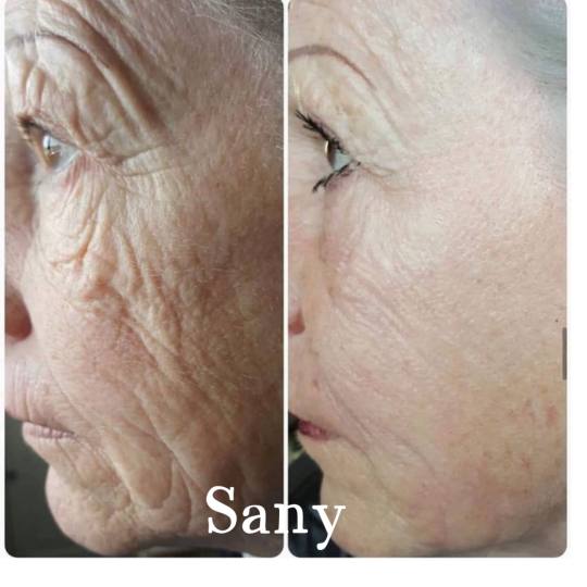 Sany Nails & Cosmetics #zagreb Tretman lica  ACCOR Cosmetics Corrector je nježna alternativa operac