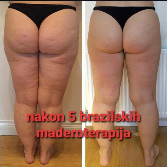 Perfect body beauty bar #zagreb Anticelulit masaža Brazilska maderoterapija - 30 minuta * Posebno o