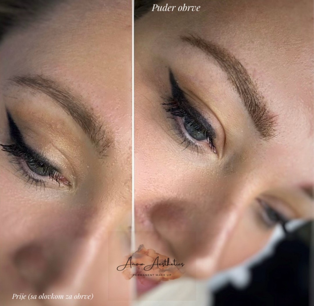 Anova Aesthetics #zagreb Trajna šminka Puder obrve