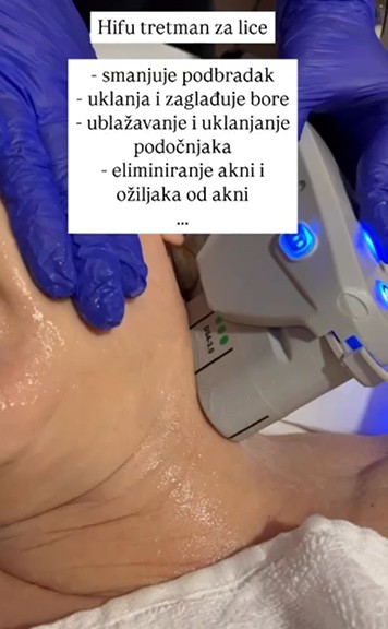 Perla #cakovec Tretman lica HIFU tretman cijelog lica + podbradka + vrata - paket od 2 tretmana