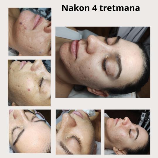 Valena estetica usluga