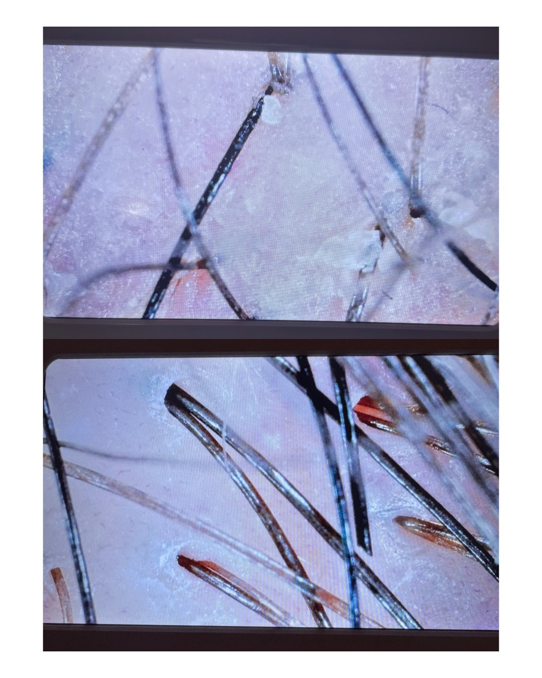 Yoko #jastrebarsko Masaža glave Japanski head spa + analiza vlasišta + sušenje kose za dame - 120 minuta