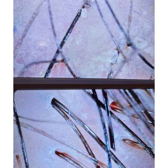 Yoko #jastrebarsko Masaža glave Japanski head spa + analiza vlasišta + sušenje kose za dame - 120