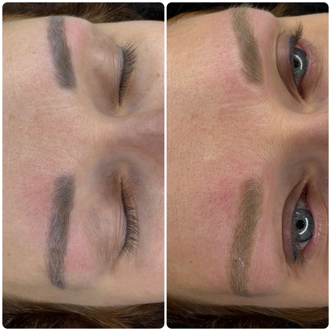 Brow Bar Permanent #zagreb Uklanjanje tetovaža Lasersko uklanjanje tetovaže - obrve