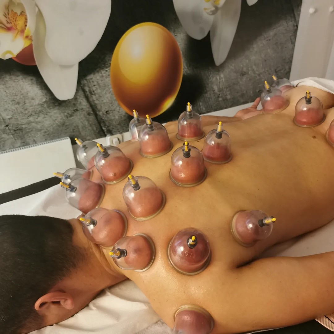 Cupping terapija + medicinska / sportska masaža - Nirvana Life Therapy, Zagreb Detoksikacija tijela Tijelo Detoksikacija tijela, Zagreb, Gornja Dubrava