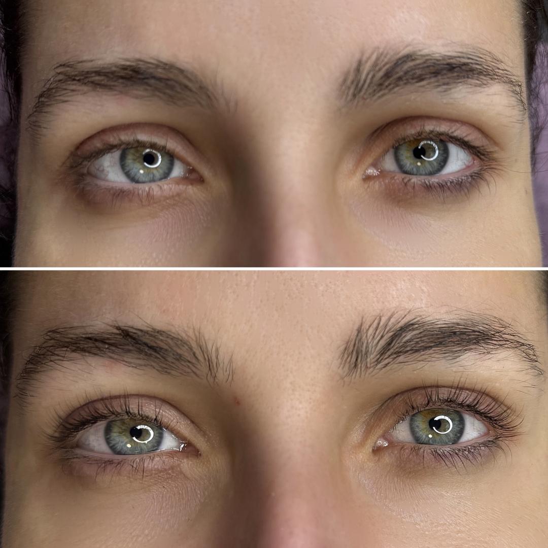 Lash lift + bojanje trepavica - Anova Aesthetics, Zagreb Trepavice Lice Trepavice, Zagreb, Trešnjevka – jug
