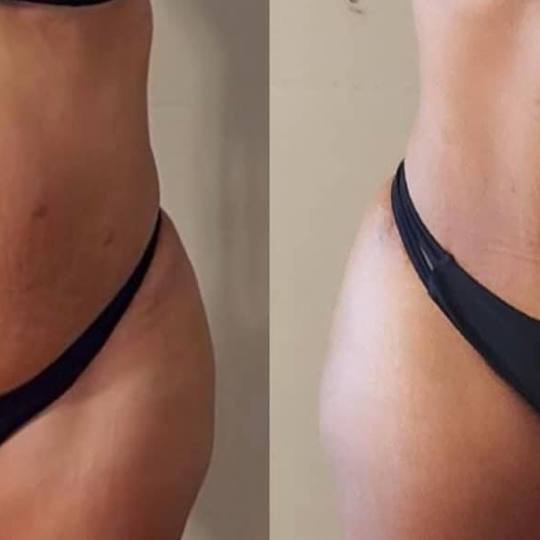 Estetix centar usluga