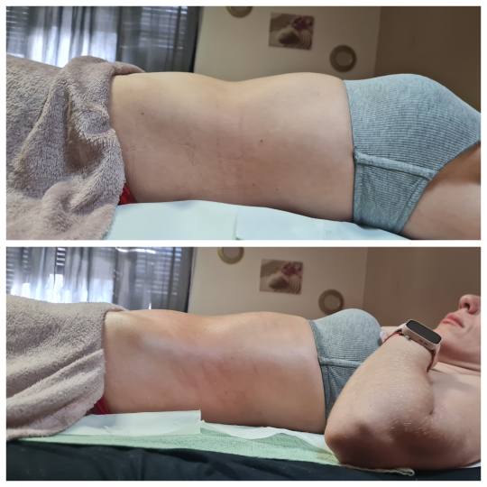 Glitter and glam #zagreb Tretmani tijela Limfno modelovanje - cijelo tijelo