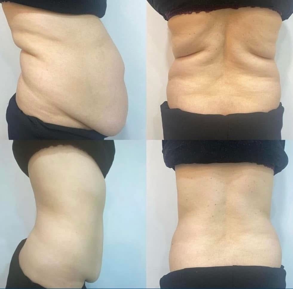 Estetix centar #zagreb