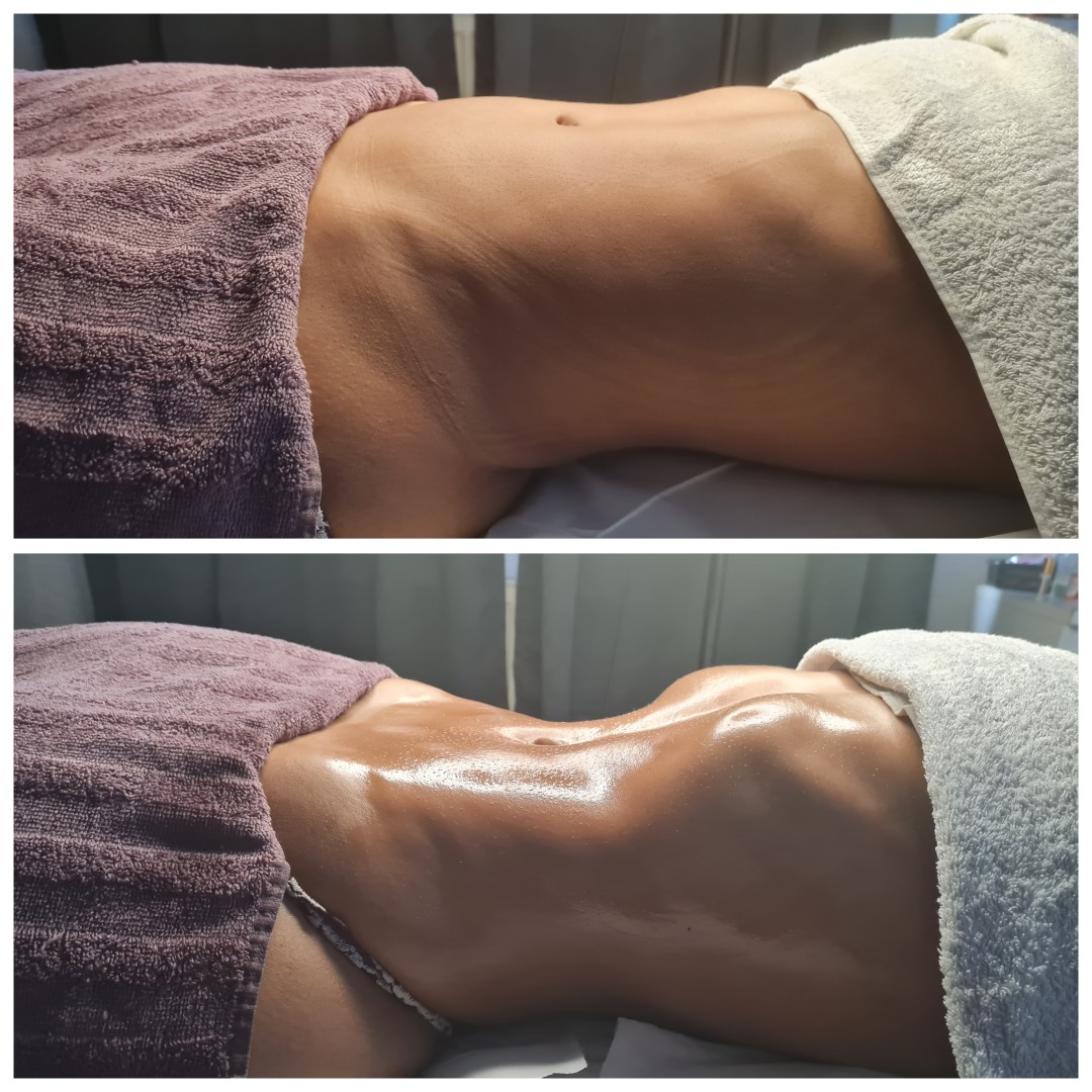 Glitter and glam #zagreb Tretmani tijela Limfno modelovanje - cijelo tijelo