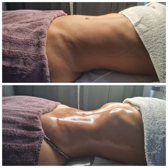 Glitter and glam #zagreb Tretmani tijela Limfno modelovanje - cijelo tijelo