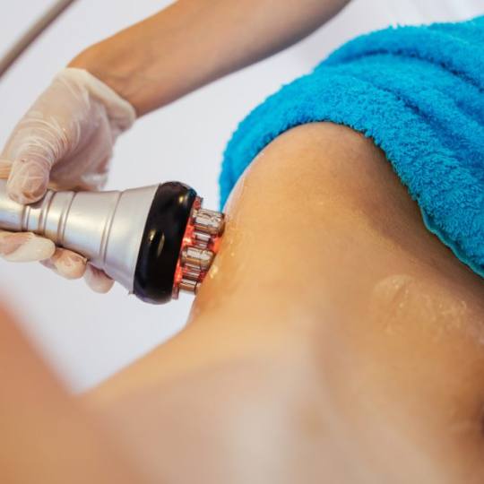 SOLO Beauty Centar #zagreb Tretmani tijela RF multipolarna lipoliza i zatezanje kože - 40 minuta