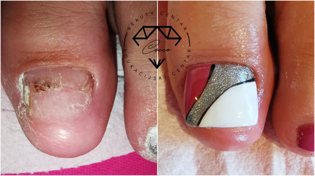 Beauty Centar By Cocco #viskovo Estetska pedikura