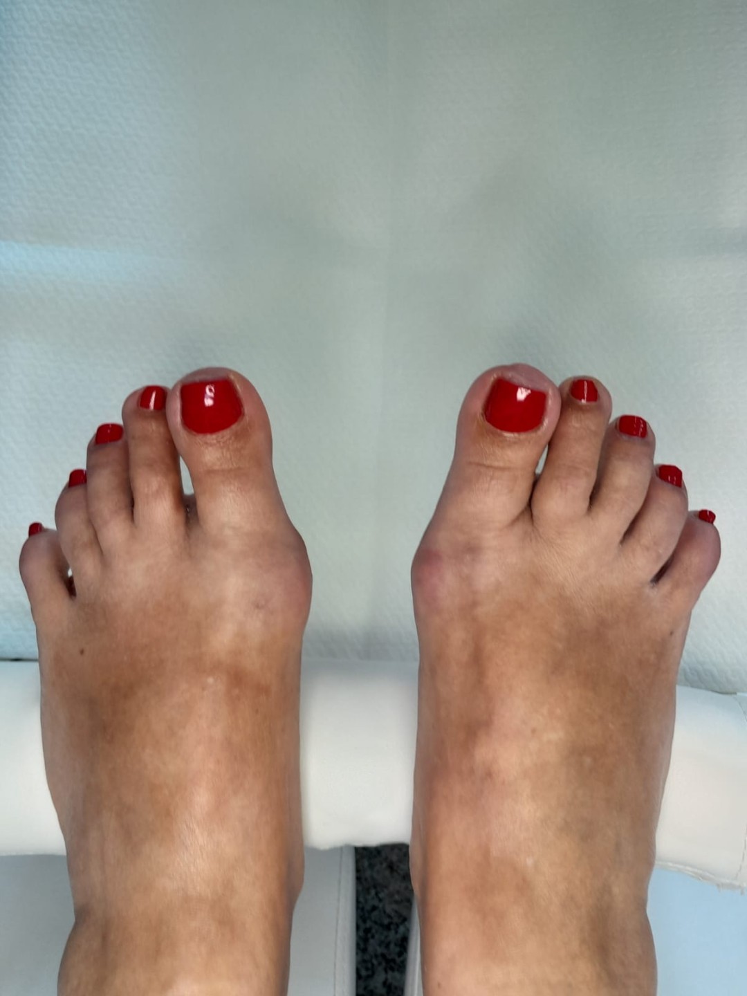 Anahata Beauty & Balance studio #zagreb Medicinska pedikura Medicinska pedikura + trajni lak