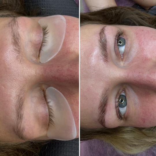 Anova Aesthetics #zagreb Obrve Brow lift + bojanje + oblikovanje obrva + aftercare set Brow lift, bo