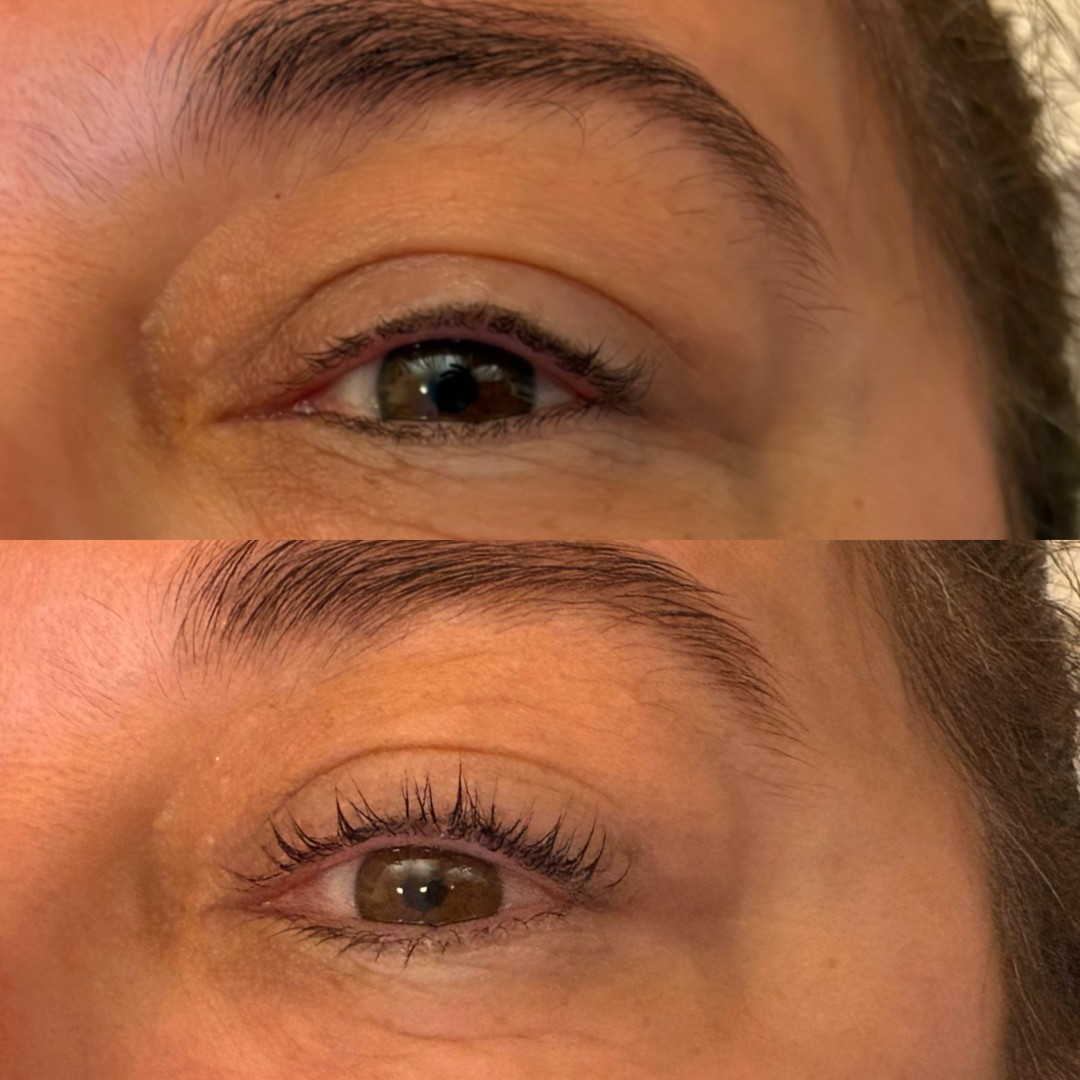 Aura #velika-gorica Trepavice Lash lift + bojanje trepavica + 3D filler