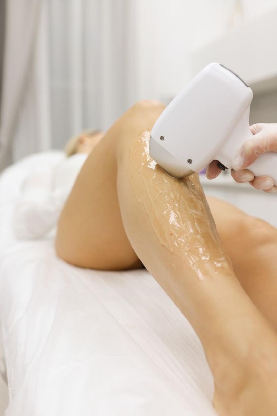 SABRINA STRIJA BEAUTY & SPA #zagreb Laserska epilacija Laserska epilacija cijelog tijela za dame - paket od 10 tretmana